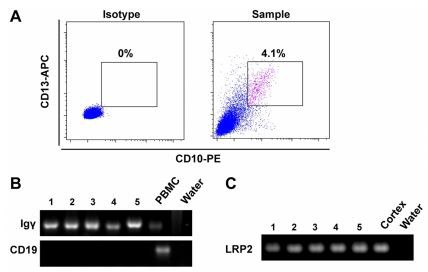 Figure 2. Rearranged IgG was detected in sorted single PTECs by nested PCR. (A) PTECs were sorted by FACS using antibodies against CD10‑PE and CD13‑APC. Figure 2. Rearranged IgG was detected in sorted single PTECs by nested PCR. (A) PTECs were sorted by FACS using antibodies against CD10‑PE and CD13‑APC.