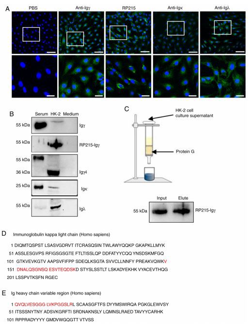 Figure 3. Expression of IgG heavy and light chains in HK‑2 cells. Figure 3. Expression of IgG heavy and light chains in HK‑2 cells.