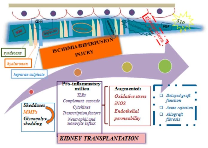 Figure 1. Clinical implications of glycocalyx damage in the setting of ischemia and/or reperfusion injury following kidney transplantation
