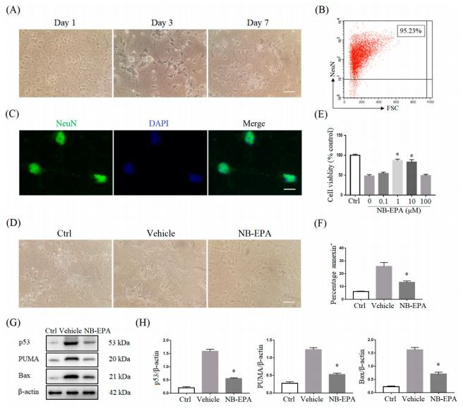 EPA reduces ischemic neuronal injury after OGD challenge